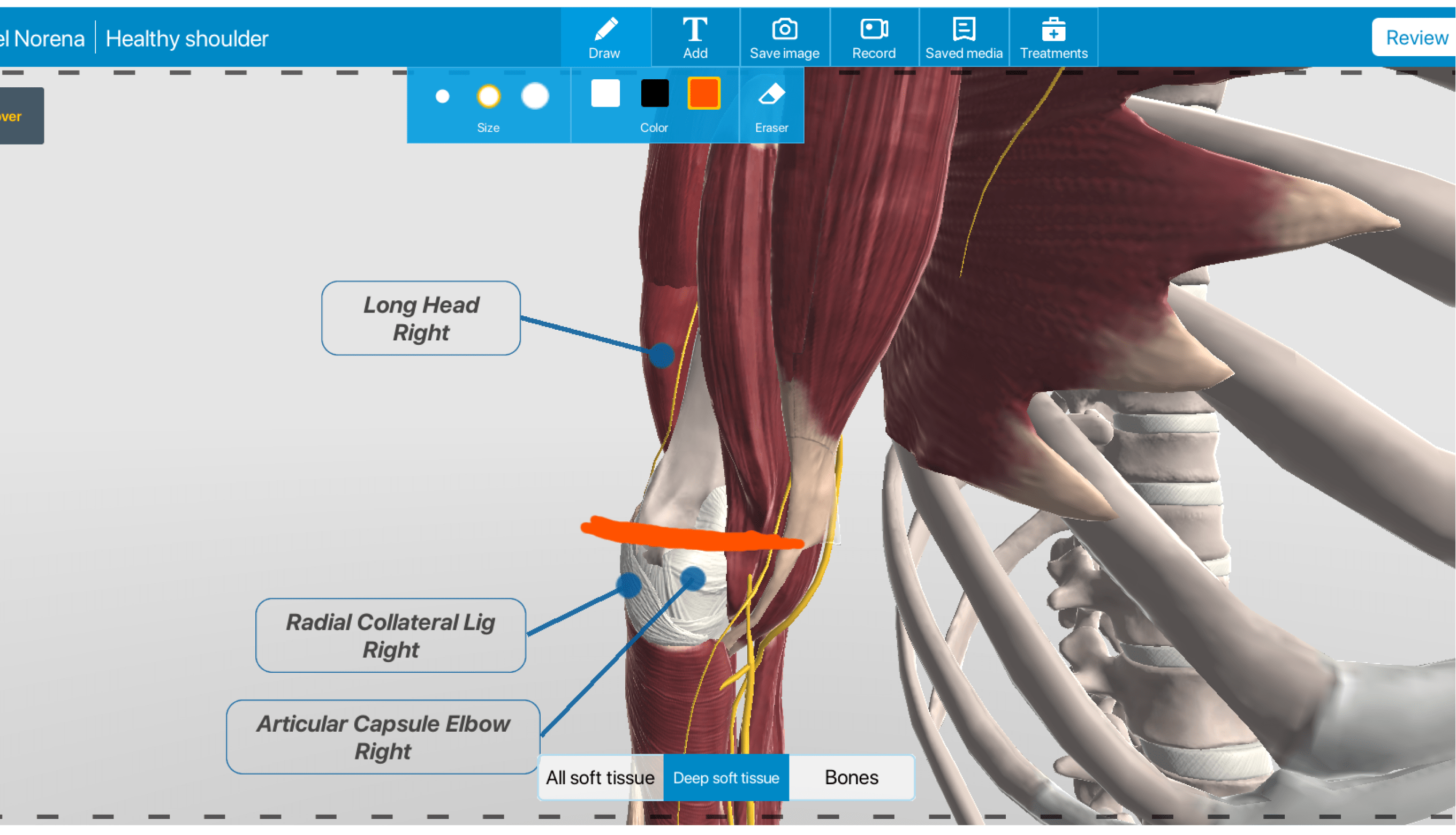 Always Health Solution Visual